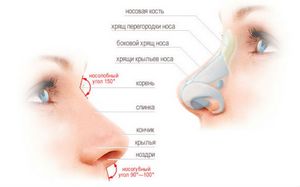 Безоперационная коррекция носа при помощи рассасывающих препаратов и гелей