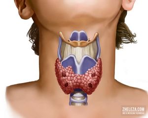 Что такое щитовидная железа? виды дисфункций