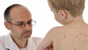 Герпетическая инфекция: что приводит к поражению кожи?