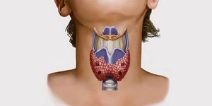 Гипотиреоз щитовидной железы у женщин: симптомы, лечение и диета