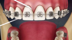 Как правильно пользоваться зубной нитью?