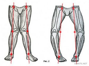 Лечение артроза коленного сустава народными средствами, гимнастика, лфк, фото и видео