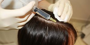 Мезотерапия для волос головы: препараты и коктейли для роста и лечения