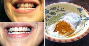Отбеливаем зубы натуральными средствами: 5 вариантов
