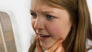 Себорейный дерматит на лице: причины и лечение кожи народными средствами
