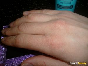 Сухая кожа: как избавиться от шелушения