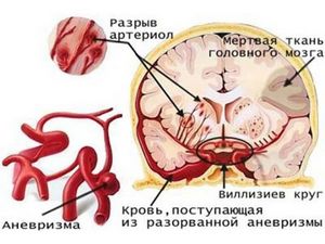 Вред алкоголя на организм человека - фото, видео с профессором ждановым